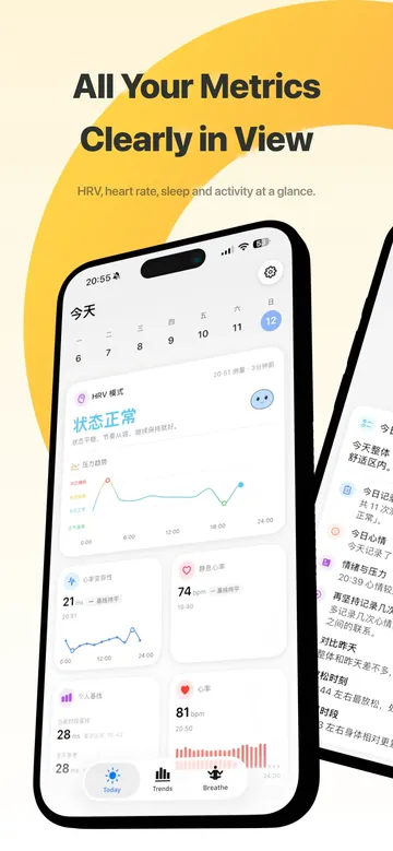 Stress app home on iPhone showing Apple Watch health data
